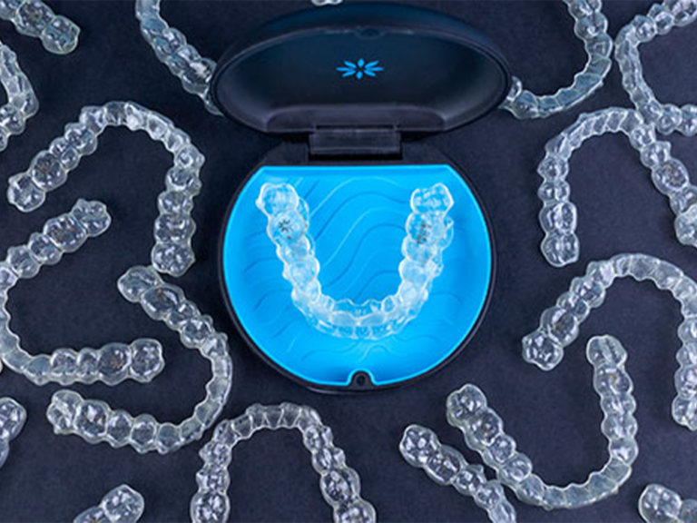 A blue dental aligner case opens, displaying a clear aligner inside. Surrounding the case are multiple clear aligners arranged on a dark surface. The aligners are used for orthodontic treatments to straighten teeth.