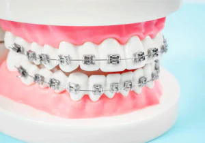 Orthodontic care in Burtonsville, MD, at Endres Dental Care