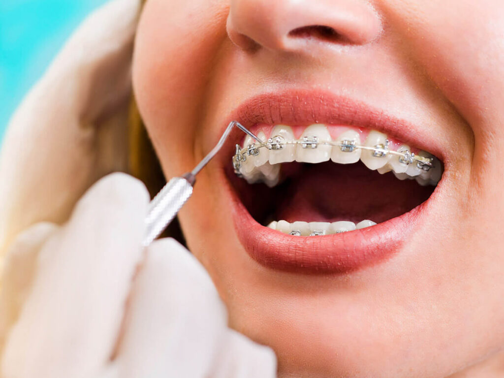 Woman having dental braces inspected