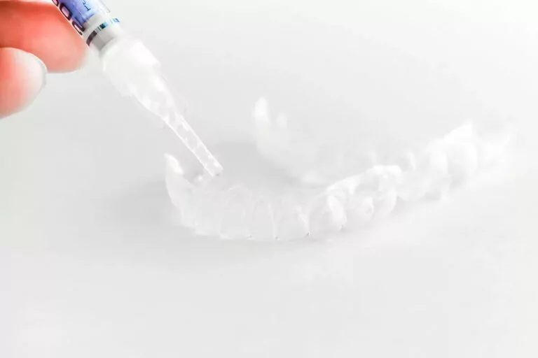 A hand holding a syringe filled with a clear substance, applying it to a clear dental aligner. The aligner is placed on a white surface, highlighting the process of preparing the aligner for use in orthodontic treatment.